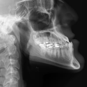 malocclusions 2021_700